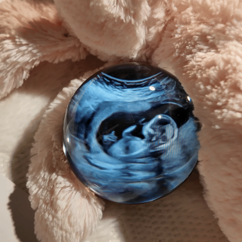 The Ultrasound Sphere™ — Sphere of Memories